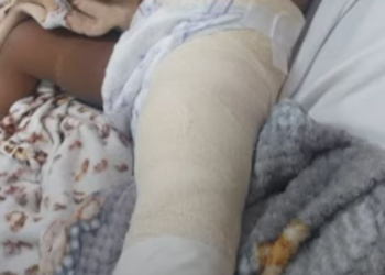 PM d1spara em suspeito e atinge bebê de 1 ano e 3 meses no interior do Amazonas