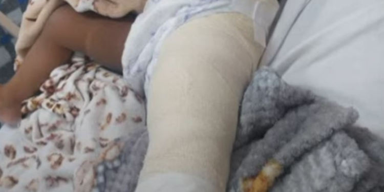 PM d1spara em suspeito e atinge bebê de 1 ano e 3 meses no interior do Amazonas