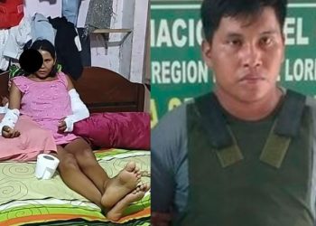 Vídeo: veja como ficou jovem que teve o olho arrancad0 pelo ex-namorado