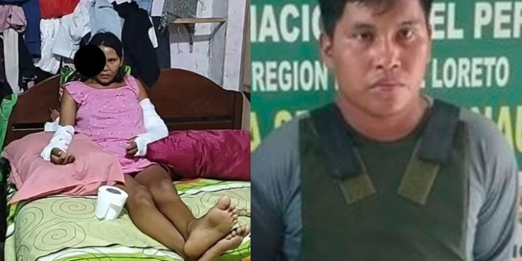 Vídeo: veja como ficou jovem que teve o olho arrancad0 pelo ex-namorado