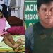 Vídeo: veja como ficou jovem que teve o olho arrancad0 pelo ex-namorado