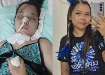 Universitária continua internada em estado delicado em Manaus e Caprichoso pede doações