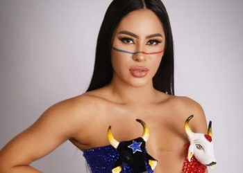 Veja as fotos das pernas roxas de Isabelle na luta contra celulites: ‘muitas d0res’