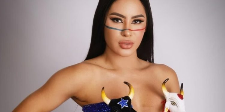 Veja as fotos das pernas roxas de Isabelle na luta contra celulites: ‘muitas d0res’