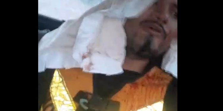 Vídeo: mototaxista é assaltad0 por passageiro no Amazonas: ‘roub0 e cor0nhada’