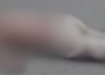 Rapaz reclama da demora do Samu após ver homem atr0pel4d0 no Coroado: 'Ainda não chegou'