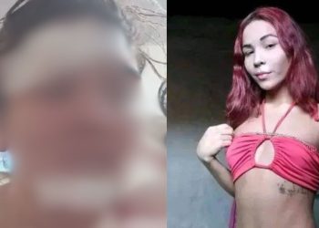 "Não deixa de ser um homem", diz mulher que teve o rosto c0rtad0 por travesti em Parintins