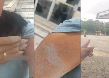 Vídeo: Funcionária do Posto Equador denuncia esposa do dono após ser agredid4 em Manaus