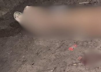 Imagem forte: jovem fica quase irreconhecível após levar tir0s no rosto em Manaus