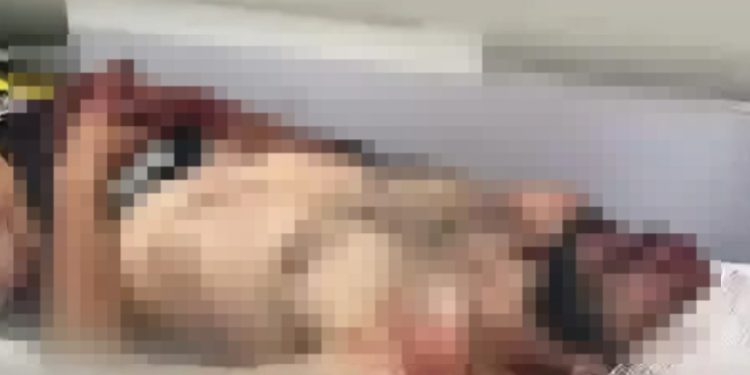 Homem despenc@ do 2º andar de prédio em Manaus