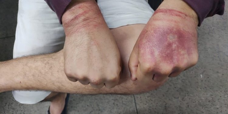Motorista de app é colocado no porta-malas durante assalt0 em Manaus