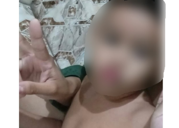 Garoto de 4 anos pode perder visão de um olho após explosão de panela em Manaus