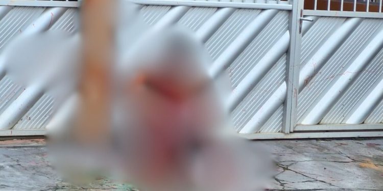 Veja: Homem fica ‘cotó’ do d3d0 e banhado de sangu3 após @taque em Manacapuru