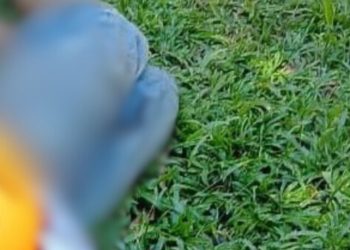 Imagem mostra como ficou o idoso que foi esf4que4d0 nas costas covardemente no AM