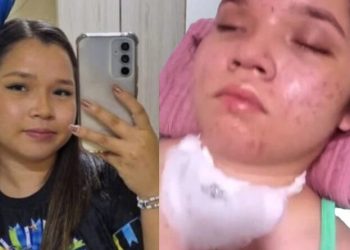 Em vídeo, família mostra estado de universitária vít1ma de ac1dente em Parintins; veja