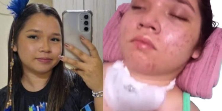 Em vídeo, família mostra estado de universitária vít1ma de ac1dente em Parintins; veja