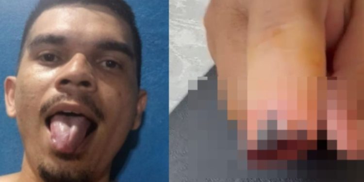 Polícia identifica homem que arranc0u dedo da namorada na dentada em Manaus; veja o vídeo