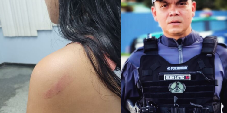 Vídeo: ‘Desequilibrado’, diz j0vem agr3dida por capitão da PM em Manaus