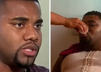 Vídeo: Davi mostra resultado da cirurgia e diz que ficou lindo: ‘Agora o pai tá lipado’