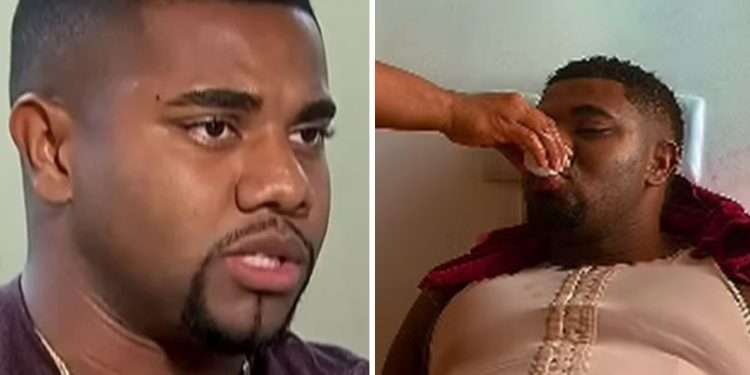 Vídeo: Davi mostra resultado da cirurgia e diz que ficou lindo: ‘Agora o pai tá lipado’