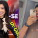 Jovem que p3rdeu os dentes após agr3ssão de cantor em Manaus vai precisar de cirurgia