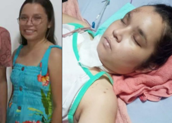 Universitária atr0p3lada em Parintins continua em estado crítico: ‘Está tetraplégica, perdeu a memória’