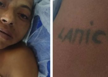 HPS João Lúcio procura familiares de mulher que caiu na escada em Manaus