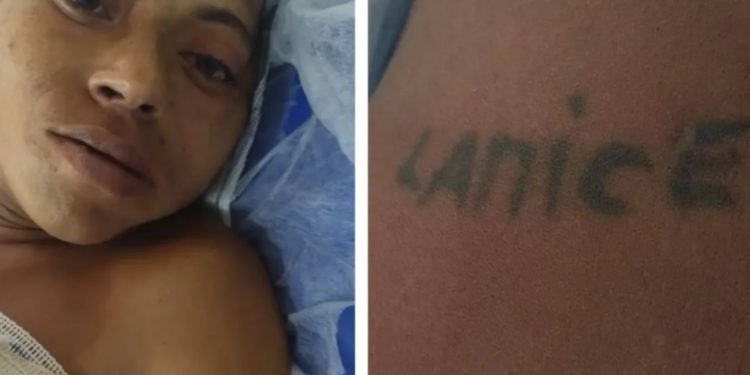 HPS João Lúcio procura familiares de mulher que caiu na escada em Manaus