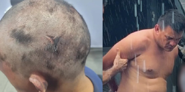 Homem que ra$p0u cabeça de mulher em Manaus a atraiu usando desculpa da pensão alimentícia