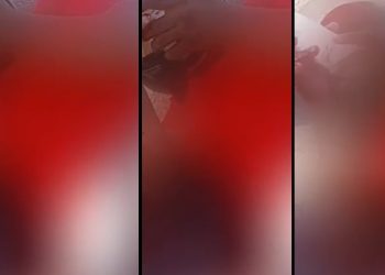 Vídeo forte: pedestre é atropelad0 e tem a perna t0rada por carro em Manaus