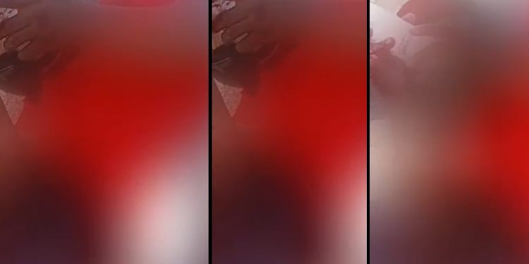 Vídeo forte: pedestre é atropelad0 e tem a perna t0rada por carro em Manaus