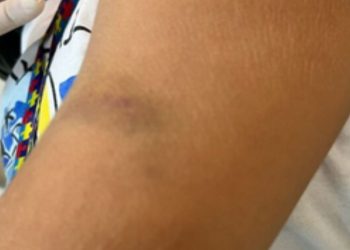 Mãe acusa professora de agredir seu filho autista de 8 anos dentro de escola particular em Manaus