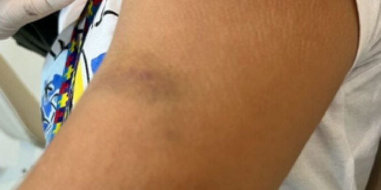 Mãe acusa professora de agredir seu filho autista de 8 anos dentro de escola particular em Manaus