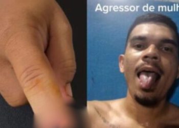 PC pede prisão do homem que arranc0u o dedo da companheira em Manaus