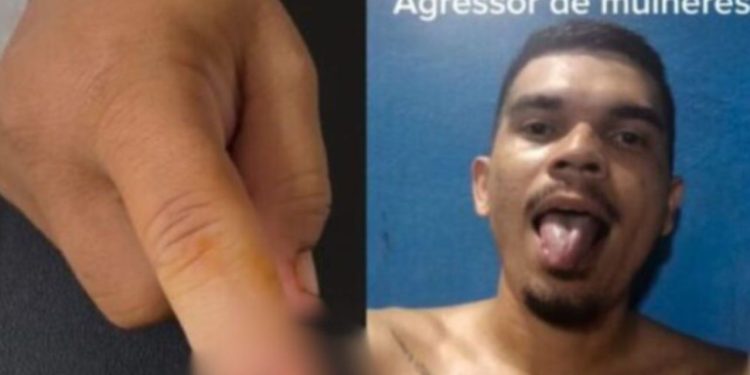 PC pede prisão do homem que arranc0u o dedo da companheira em Manaus