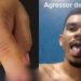 PC pede prisão do homem que arranc0u o dedo da companheira em Manaus