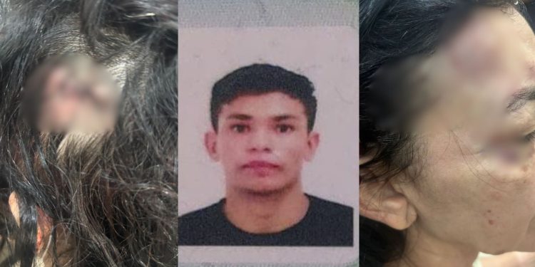 Polícia investiga lutador de Jiu-Jitsu por agressã0 à namorada em Manaus