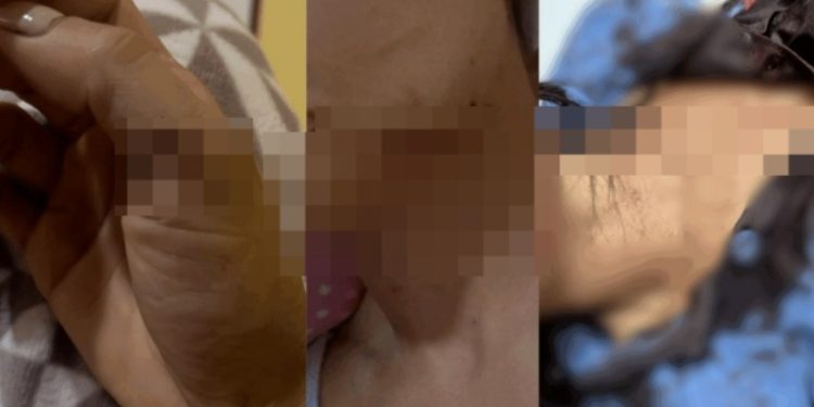 Imagem forte: ex-marido é acusad0 de c0rtar várias partes do c0rpo da ex-esposa em Manaus