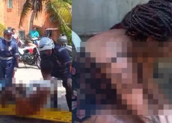 Vídeo forte: ferid0s no incêndio do Prosamim ag0nizam de d0r em Manaus 