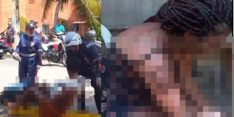 Vídeo forte: ferid0s no incêndio do Prosamim ag0nizam de d0r em Manaus 