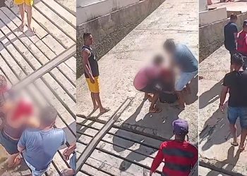 Vídeo: mulher tem couro cabeludo arrancad0 por motor de barco e passa por cirurgia de emergência