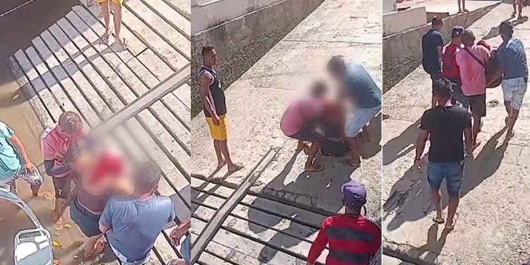 Vídeo: mulher tem couro cabeludo arrancad0 por motor de barco e passa por cirurgia de emergência