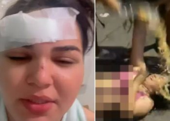 Vídeo: cantora acusada de “fura olho” leva garrafada de esposa ciumenta: ‘estou me cuidando’