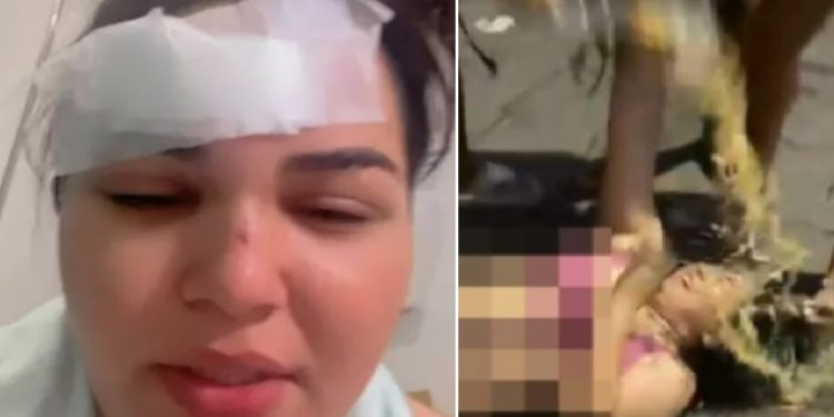 Vídeo: cantora acusada de “fura olho” leva garrafada de esposa ciumenta: ‘estou me cuidando’