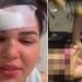 Vídeo: cantora acusada de “fura olho” leva garrafada de esposa ciumenta: ‘estou me cuidando’