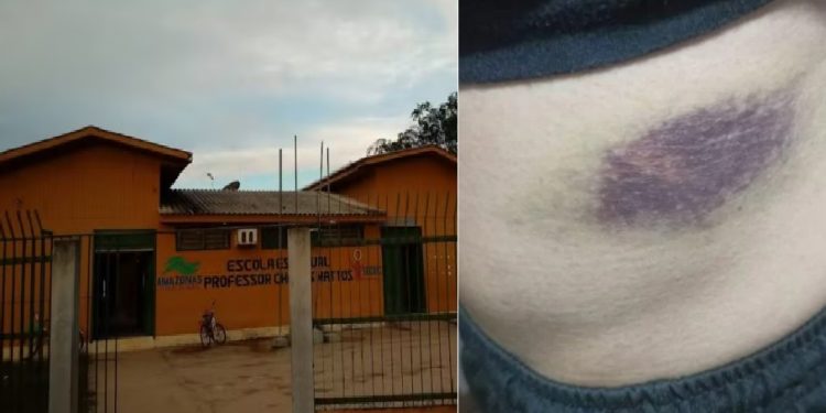 Professor faz B.O. contra aluna e apanha do namorado dela no Amazonas: ‘estamos com medo’