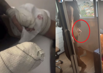 Vídeo: Miss Grand Amazonas deixou o namorado todo e$faquead0 e alega legítima defesa