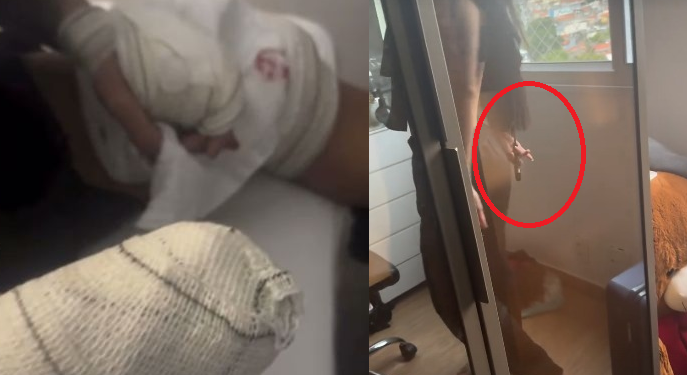 Vídeo: Miss Grand Amazonas deixou o namorado todo e$faquead0 e alega legítima defesa