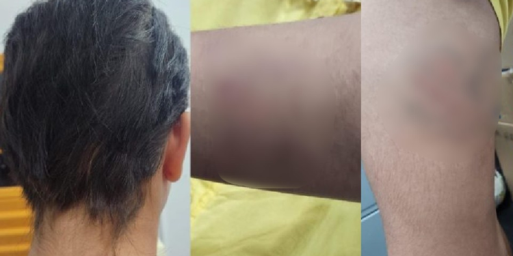 Mãe é presa por agredir filha de 13 anos e cortar seu cabelo com faca em Manaus