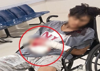 Jovem bal3ad0 nas mãos é abandonado em hospital de Manaus em possível ação do ‘Tribunal do cr1m3’